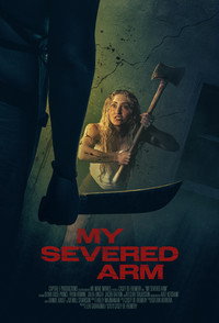 My Severed Arm