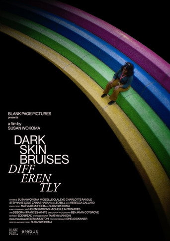 Dark Skin Bruises Differently