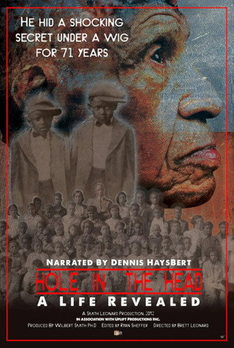 Hole in the Head: A Life Revealed